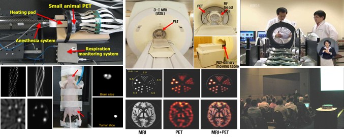 PET-MRI 시스템