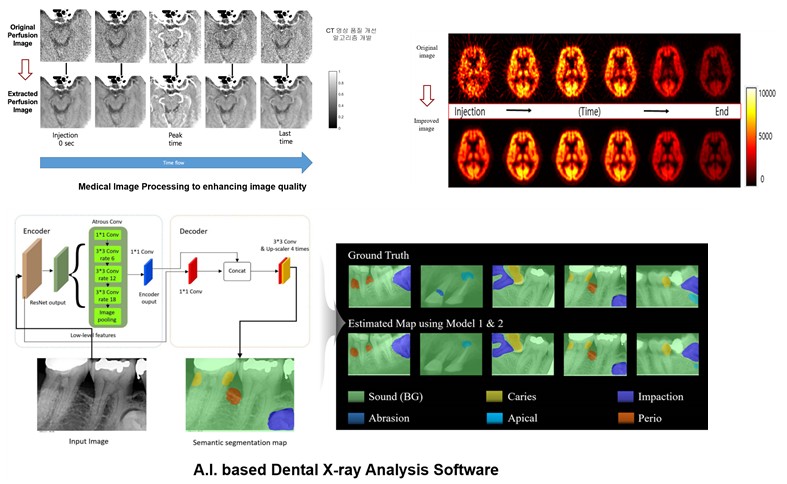 지능형 의료영상(신호)처리 알고리즘 연구